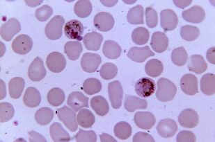 Malaaria plasmodium
