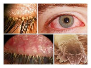parasiitide esinemise sümptomid inimese naha all