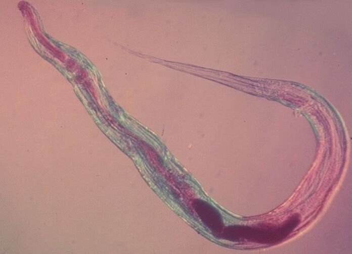 Pinworm mikroskoobi all