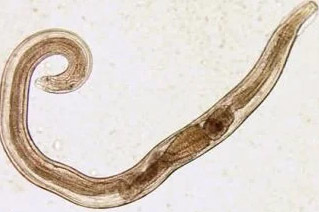 parasiidid on inimese threadworm